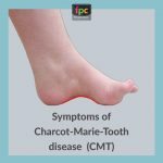 charcot marie tooth