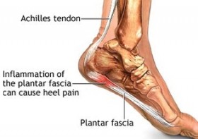 plantar-fascia