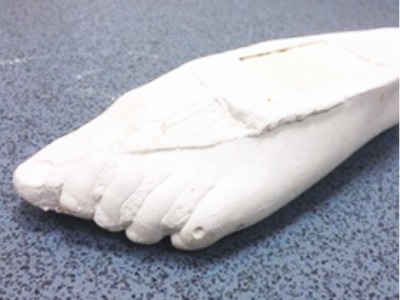 Positive plaster foot cast