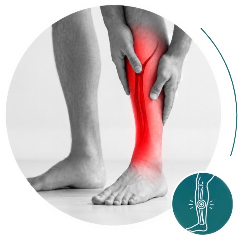 Conditions button Shin Splints