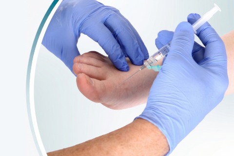 steriod injection in the foot