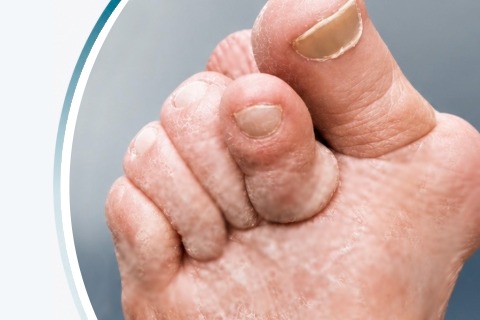 Foot surgery in Leeds
